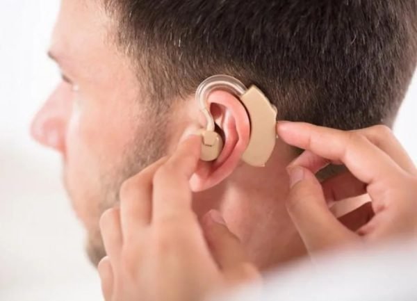 photo_2024-05-28_00-00-03 AUDIFONO AMPLIFICADOR PARA SORDERA